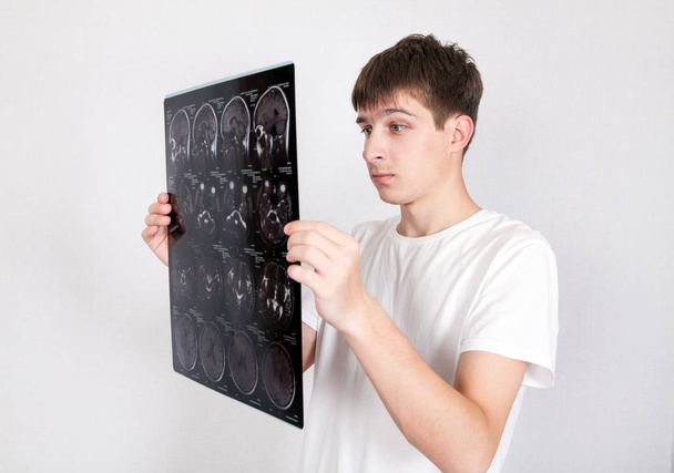 Young Man with Tomography - Fotoğraf, Görsel