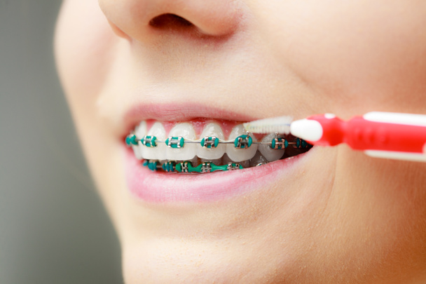 Woman with teeth braces using interdental brush - 写真・画像
