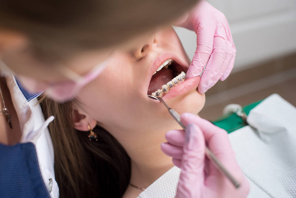οδοντίατρος έλεγχο επάνω δόντια ασθενών με παρένθεση  - Φωτογραφία, εικόνα