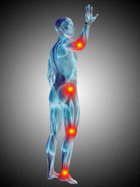 Тіло анатомії людини з болем
 - Фото, зображення
