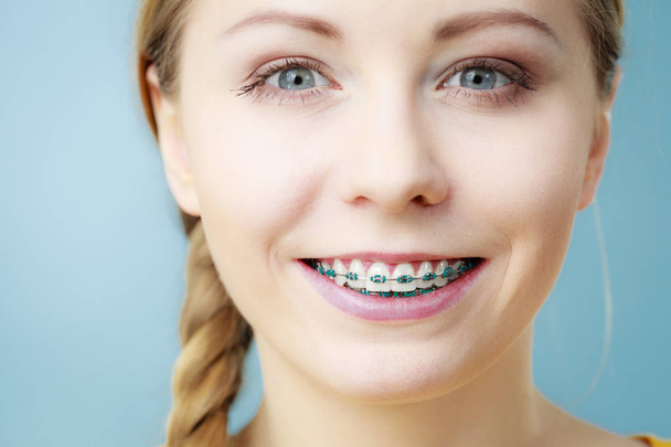 Young woman showing teeth braces - Zdjęcie, obraz