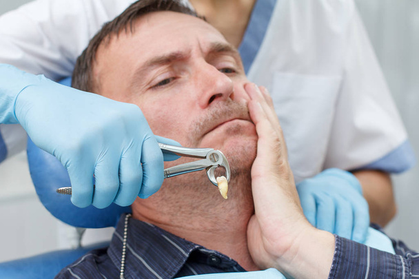 Tandarts heeft een zieke tand geëxtraheerd uit patiënt in tandheelkundige kantoor - Foto, afbeelding