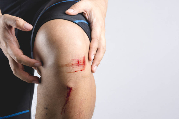 Świeży siniak kolana rany szkody z niektórych małych le kamienia i kurz - Zdjęcie, obraz