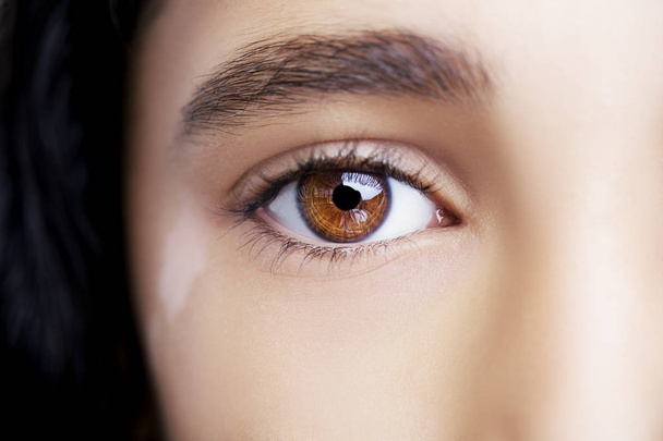 Un ojo hermoso mirada perspicaz con vitiligo. Primer plano. - Foto, Imagen