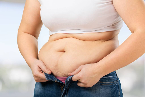 Woman with fat belly  - Valokuva, kuva