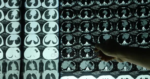 4 k artsen studeren schedel hersenen X-ray film voor analysis.health medisch ziekenhuis. - Video