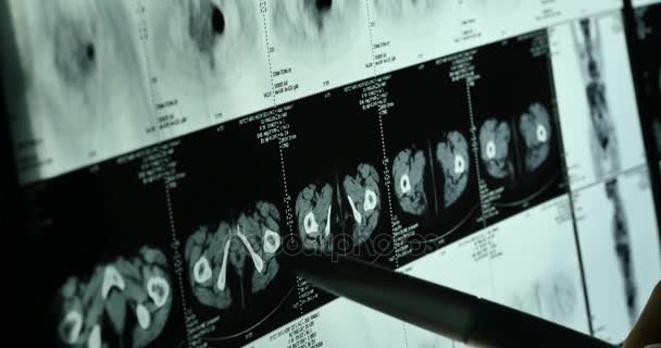 Les médecins 4k étudient le film radiographique du cerveau du crâne pour l'analyse.hôpital médical de santé
. - Séquence, vidéo