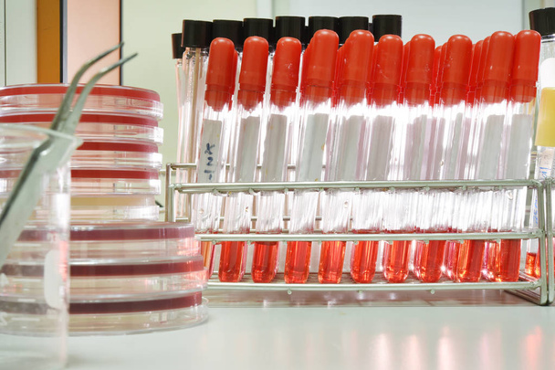 análises ao sangue em laboratório
  - Foto, Imagem