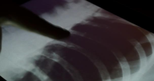 4k doctor touch pet-ct Röntgenfilm auf Touchscreen ipad App Software zur Analyse - Filmmaterial, Video