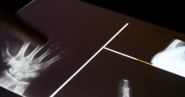 Filme de raios X 4k Doctor touch PET-CT no software aplicativo touchscreen ipad para análise
 - Filmagem, Vídeo