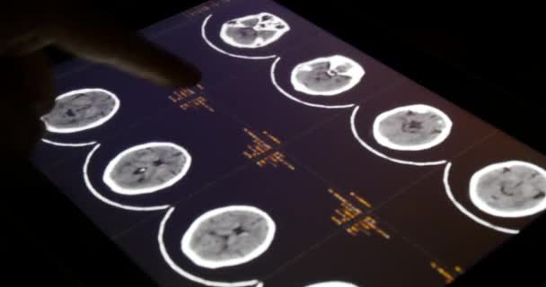 4k Doctor touch PET-CT X-ray film on touchscreen ipad app software for analysis - Footage, Video