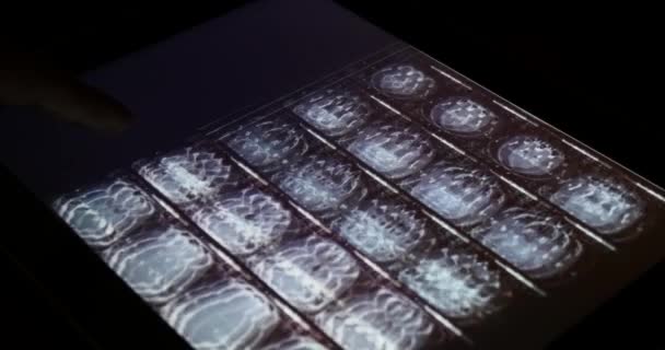4 k arts touch Pet / Ct X-ray film op touchscreen ipad app software voor analyse - Video
