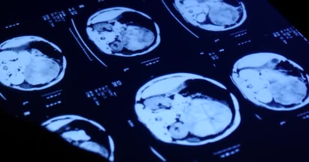Filme de raios X 4k Doctor touch PET-CT no software aplicativo touchscreen ipad para análise
 - Filmagem, Vídeo