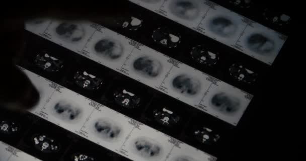 4k-Arzt, der ct-Röntgenfilm auf Touchscreen ipad App-Software zur Analyse betreibt - Filmmaterial, Video