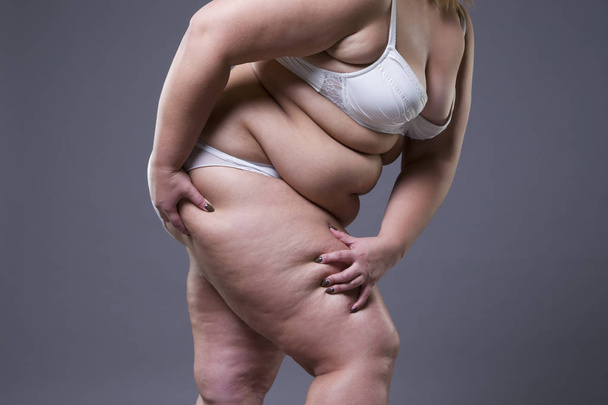 Overweight woman with fat legs, obesity female body - Foto, afbeelding