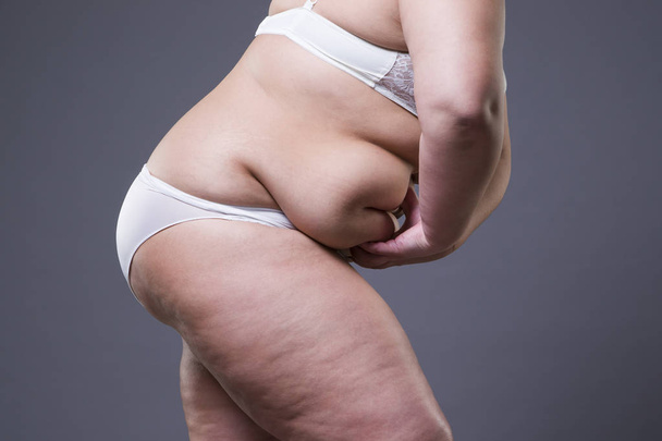Overweight woman with fat abdomen, obesity female body - 写真・画像