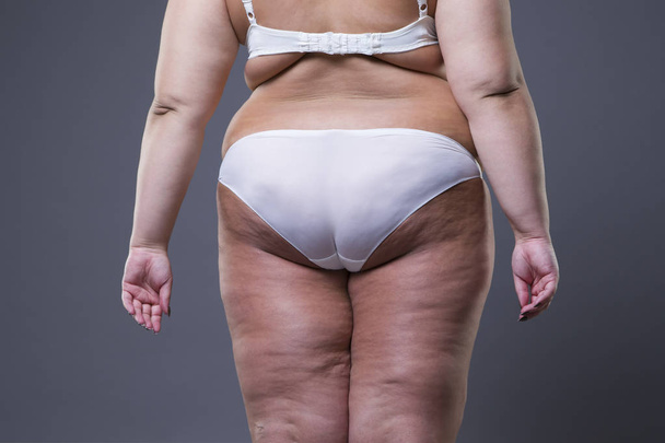 Overweight woman with fat legs and buttocks, obesity female body - Fotografie, Obrázek