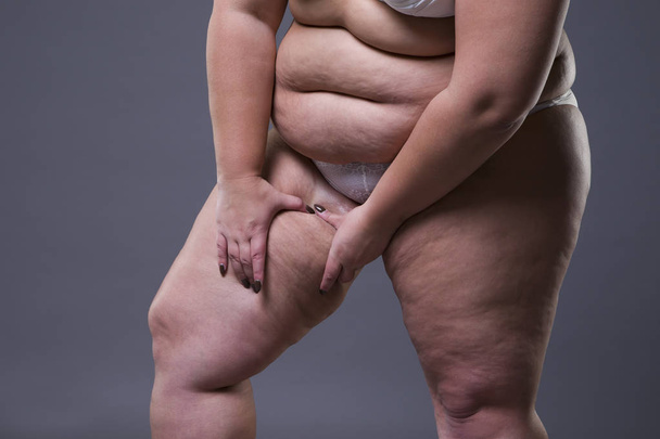 Overweight woman with fat legs, obesity female body - Фото, зображення