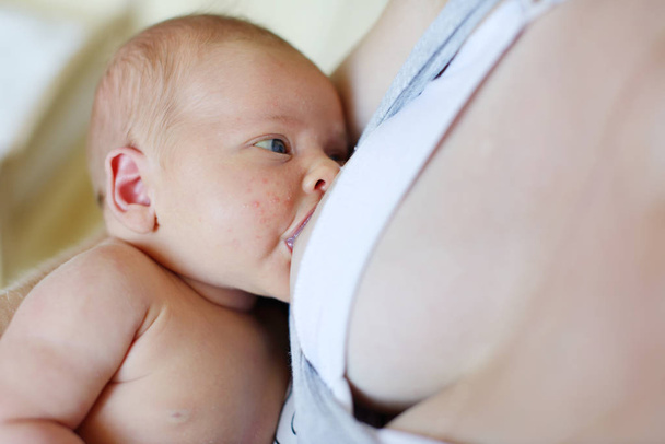 newborn baby breastfeeding, baby with a baby rash - Фото, изображение