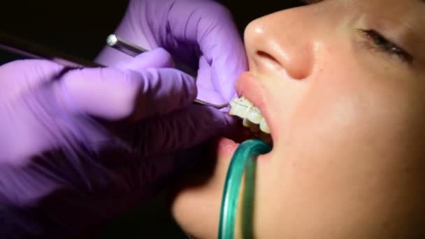 Zubař nastaví pevné roztáhnout na pacientův chrup - Záběry, video