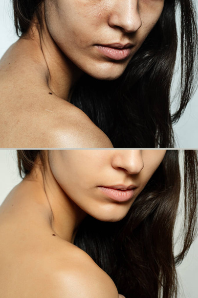 Before and after cosmetic operation. - Foto, immagini