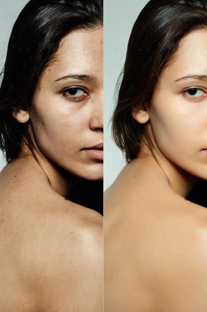 Before and after cosmetic operation. - Foto, Bild