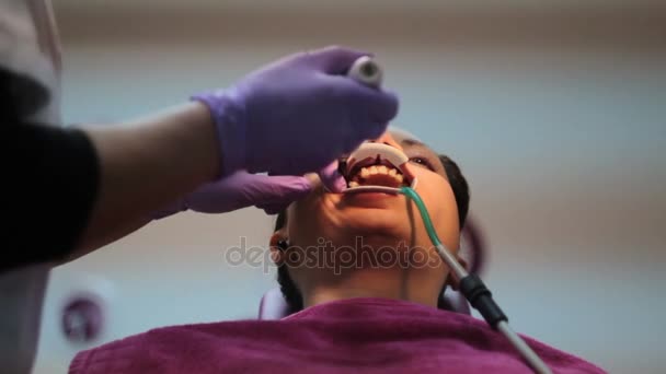 Finishing process of putting braces on teeth of young woman  - Footage, Video