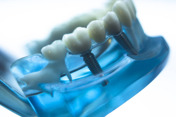 Hammaslääkärit hampaiden malli
 - Valokuva, kuva
