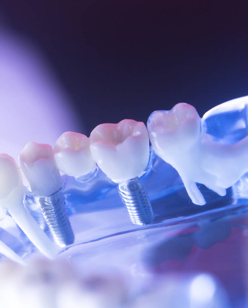 Fogorvos fogászati fogat modell - Fotó, kép