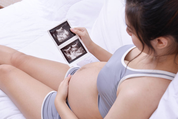 Women are pregnant looking at the baby's ultrasound image. - Photo, Image