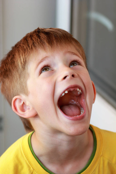 Retrato de um rapaz com uma t-shirt amarela cujos dentes de leite caíram
 - Foto, Imagem