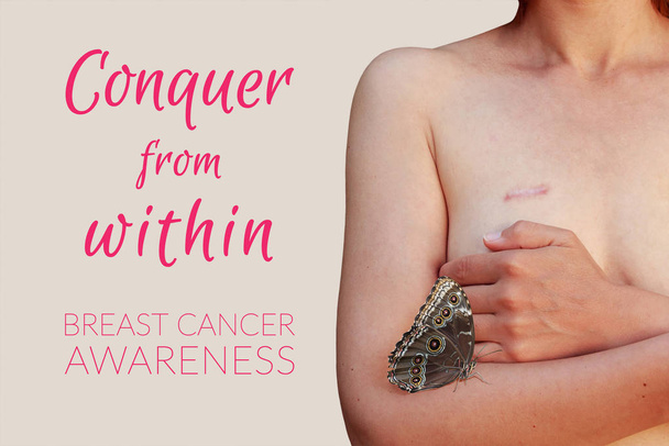 Mujer caucásica con cicatriz de cáncer de mama en el fondo gris
 - Foto, Imagen