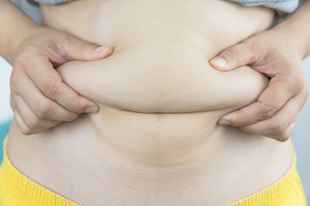太りすぎの女性手持ち株脂肪腹の - 彼女はいくつかの重量を失うだろう - 写真・画像