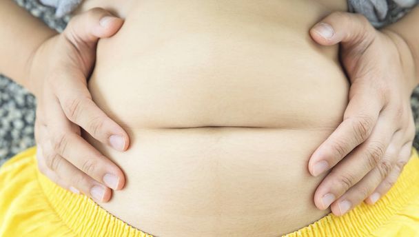 Fette übergewichtige Frau kneift ihren dicken Bauch zusammen - sie wird etwas abnehmen müssen - Foto, Bild