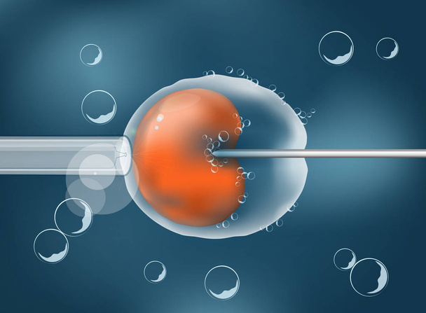 In vitro fertilizaci. IVF. Obrázek snadno upravitelné pro váš - Vektor, obrázek