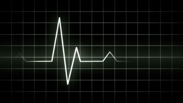 wyświetlacza EKG - Materiał filmowy, wideo
