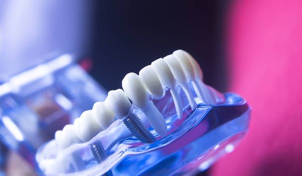 Dentists dental tooth model - Valokuva, kuva