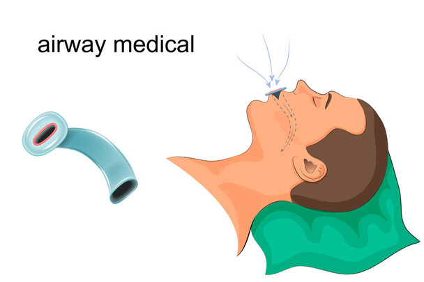 medical the duct in the mouth - Vector, Image