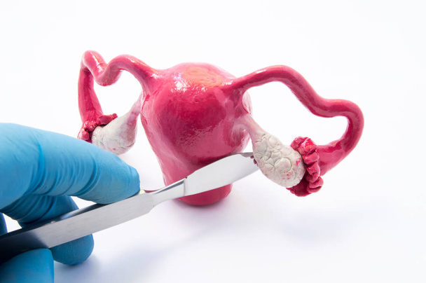 Ovarian gynecologic surgery concept. Hand of surgeon with scalpel near female genitals symbolizes surgical intervention such as cancer, removing ovaries and tubes, cysts and cystectomy as treatment - Fotografie, Obrázek