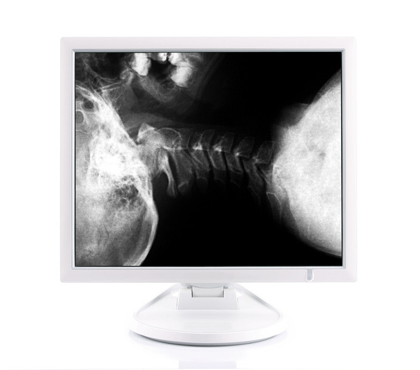 Рентгенівське зображення та комп'ютер
 - Фото, зображення