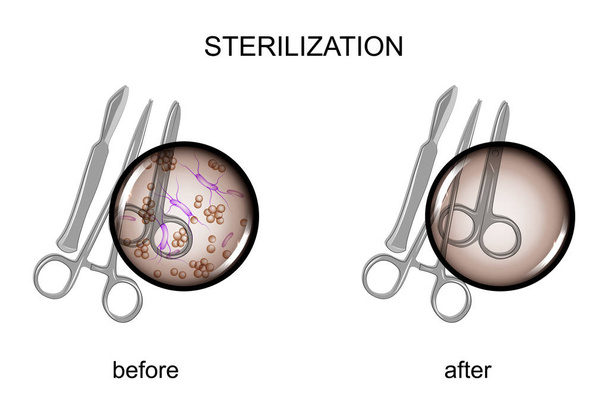 surgical instruments before and after sterilization - Vector, Image
