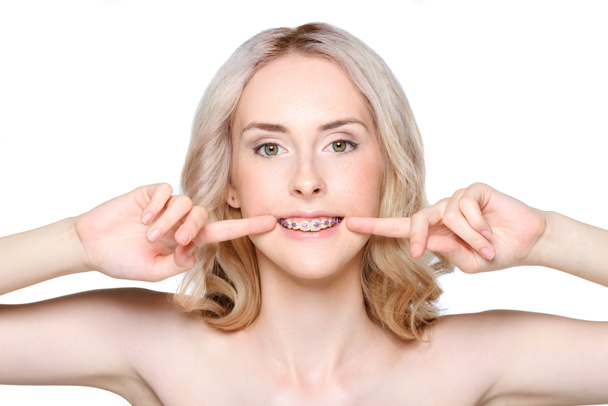 Femme pointant vers les dents avec des bretelles
 - Photo, image