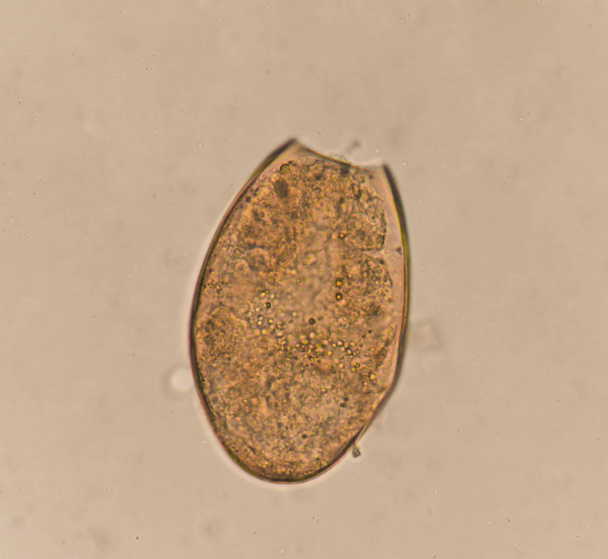 Egg parasite in stool human - Photo, Image