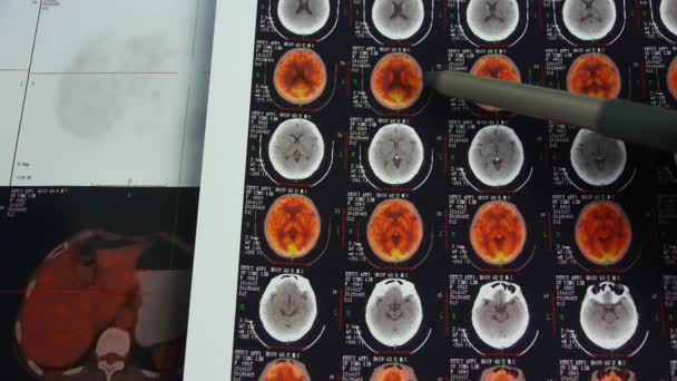 dokter studie kleur hoofd pet / ct, schedel hersenen X-ray. - Video