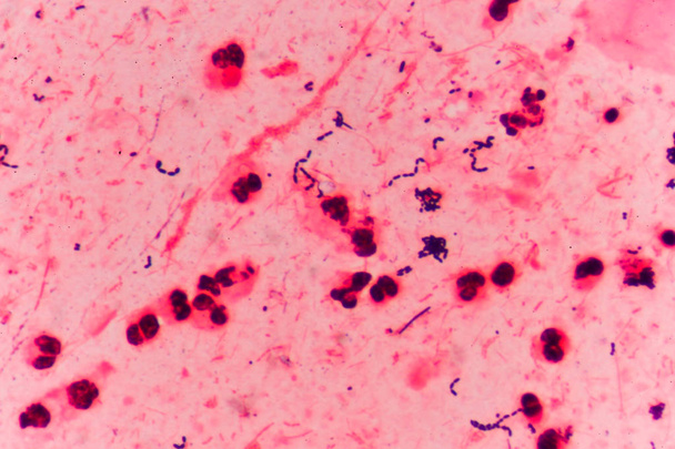 Células bacterianas Cocos Gram positivos em cadeia
 . - Foto, Imagem