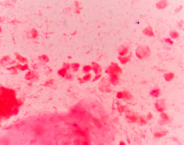 Células bacterianas Cocos Gram positivos em cadeia
 . - Foto, Imagem