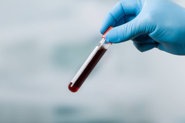 mão segurando uma sonda de sangue
 - Foto, Imagem