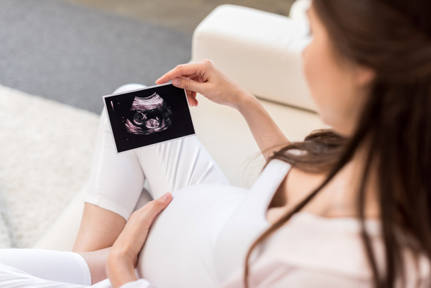 Ultrason resmi bakarak hamile kadın - Fotoğraf, Görsel