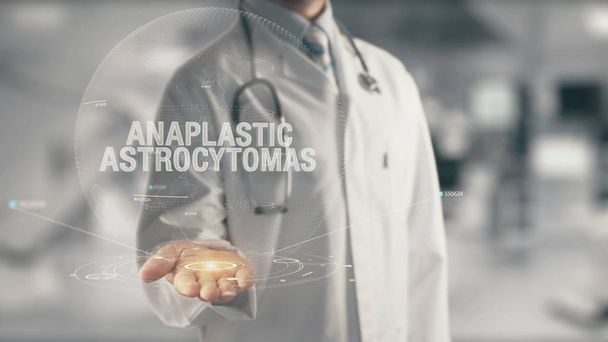 Arzt hält anaplastische Astrozytome in der Hand - Foto, Bild