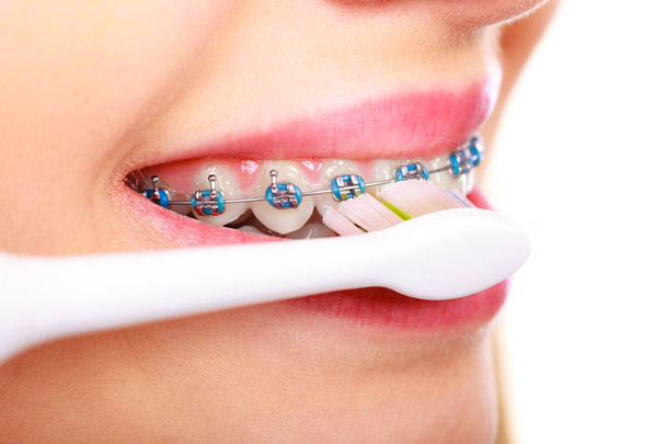 Woman brushing teeth with braces using brush - 写真・画像